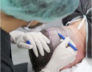 Hermest Hair Transplant Center, Turkey
