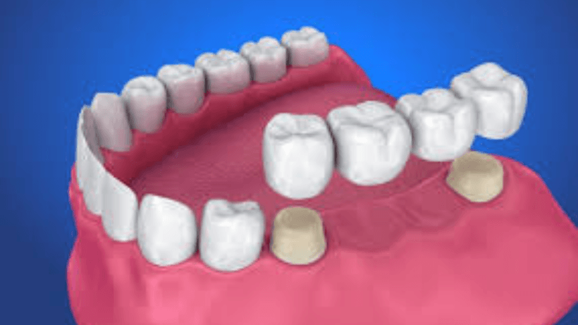 Dental Treatment