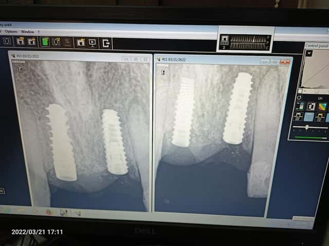 Teeth Care Multispecialty Hospital