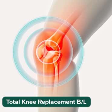 TOTAL KNEE REPLACEMNET (BILATERAL)