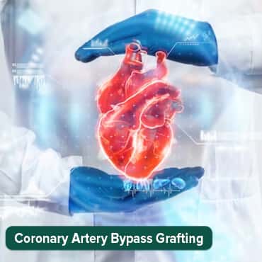Coronary Artery Bypass Graft Surgery (CABG)