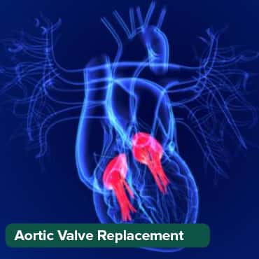 AVR