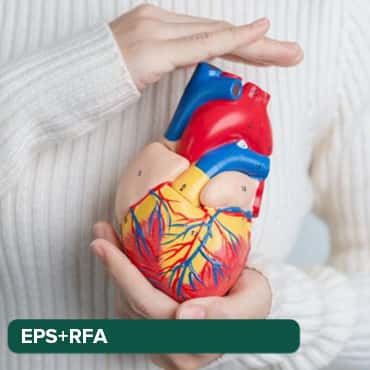Carto mapping with RF Ablation