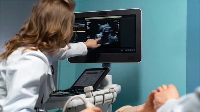 4D Ultrasound