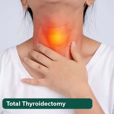 TOTAL THYROIDECTOY