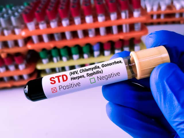 Advanced STD Panel