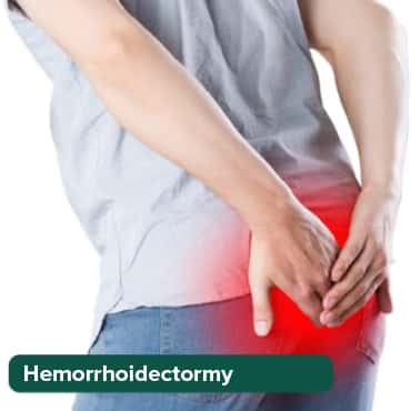 Hemorrhoidectormy