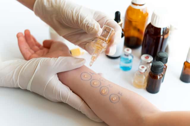 Combo-Pack for Allergic Skin Prick Test & Skin Test for Food Allergies