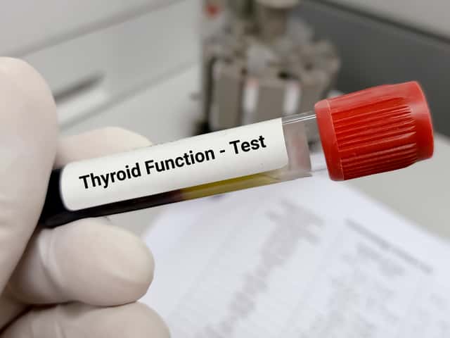 TSH(Screening for thyroid disease)