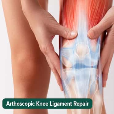Arthoscopic Knee Ligament Repair